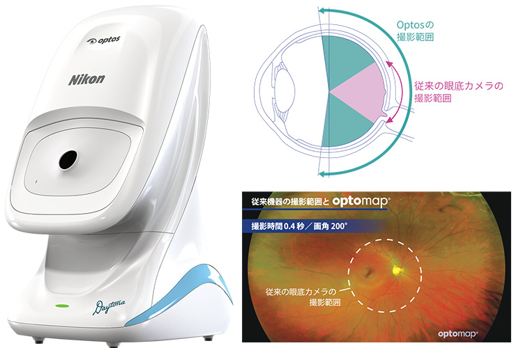 超広角眼底カメラ Optos Daytona Next